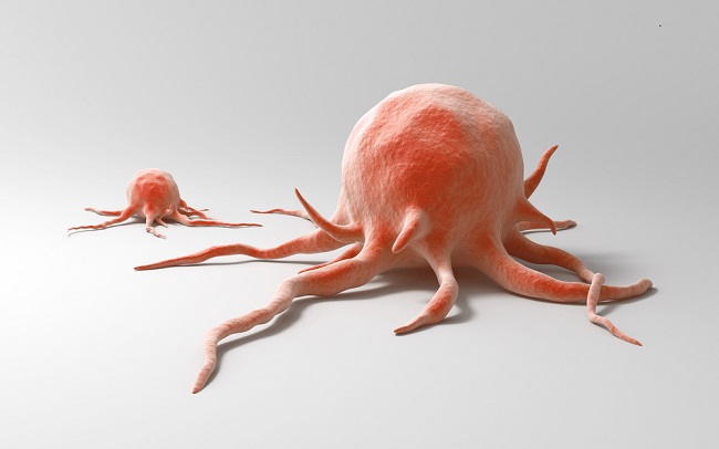 Fakta Mengejutkan Tentang Bahaya Kanker bagi Tubuh